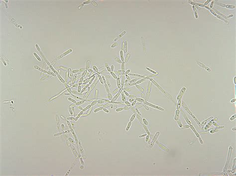 Brettanomyces bruxellensis / Dekkara bruxellensis • BiosistoStandard Tips & Tricks