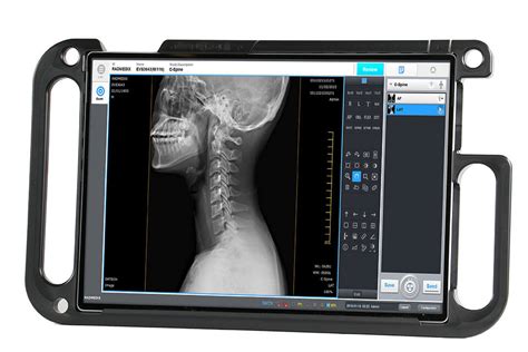 Portable & Mobile Digital X-Ray Systems | RadmediX Acuity DR