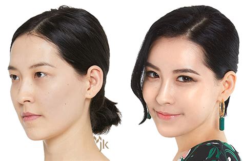 Here's Why 1 In 3 South Korean Women Say They've Had Plastic Surgery