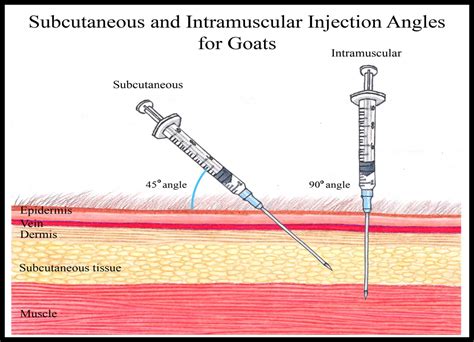 How to Give a Goat an Injection