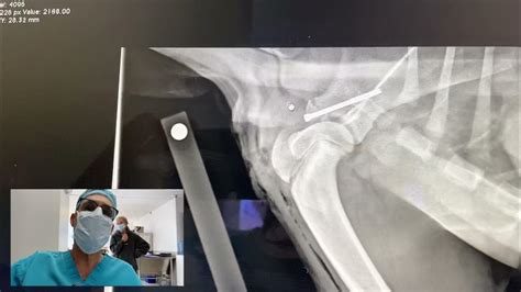 Postoperative radiographs on dog ith supraglenoid tubercle fracture - YouTube