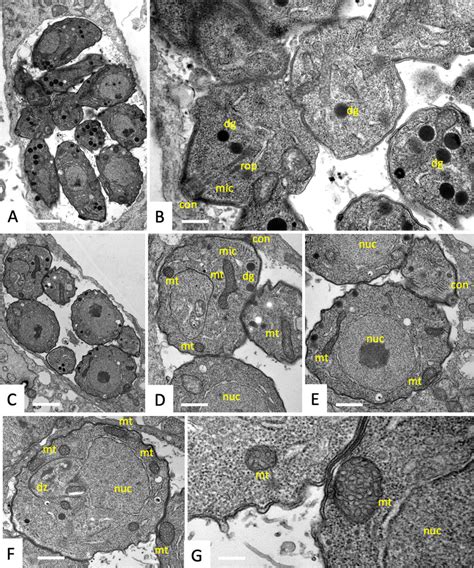 Ultrastructure of T. gondii tachyzoites cultured in human foreskin... | Download Scientific Diagram