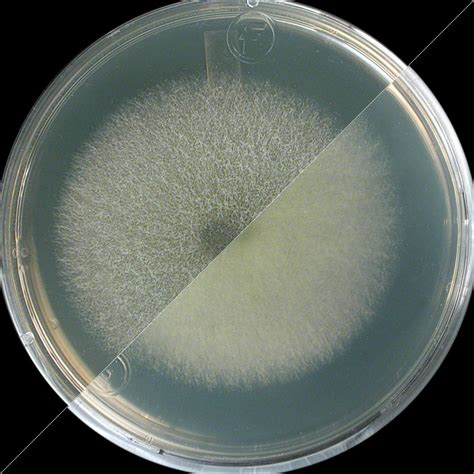 Aspergillus fumigatus | Institut national de santé publique du Québec