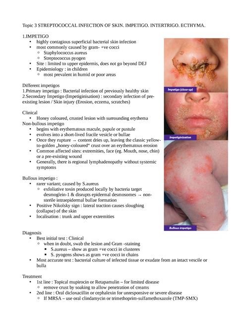 Topic 3 Streptococcal Infection OF SKIN. Impetigo. Intertrigo. Ecthyma - Topic 3 STREPTOCOCCAL ...