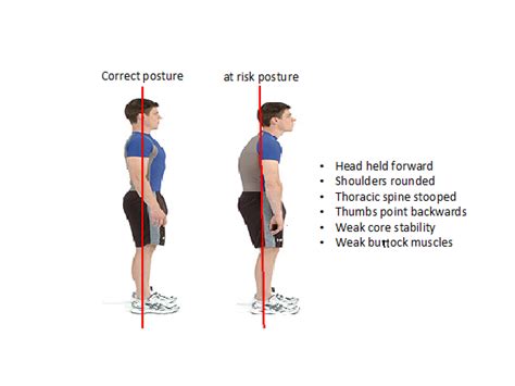 Shoulder Impingement/Bursitis