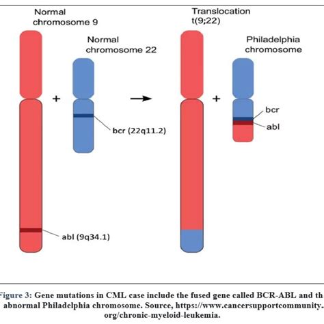 Overview of Molecular Quantification of the BCR-ABL Oncogene in CML ...