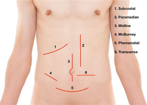 Langer’s Lines and Surgical Incisions - Medical Exam Prep