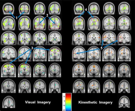 Areas of brain activation for visual motor imagery and kinesthetic ...