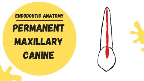 Endodontic Anatomy of the Permanent Maxillary Canine | Root canal anatomy - YouTube