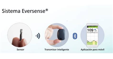 El nuevo sensor Eversense®: un estudio evalúa su precisión | Guía ...