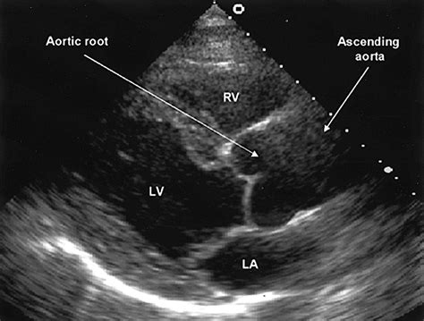 Best iPhone & iPad apps for echocardiography