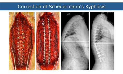 mehdianspine.com - Interesting Cases