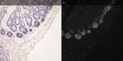 In-situ hybridization | Precisionary Instruments