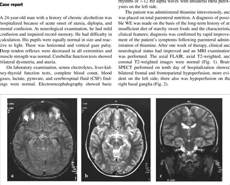 a-c Brain MRI of a patient with Wernicke's encephalopathy. a Axial ...