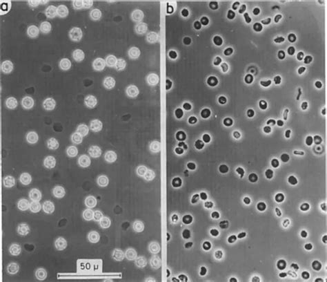 Basics Of Phase Contrast Microscopy | Smacgig World