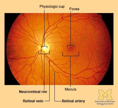 Retina & Optic Nerve Through Ophthalmoscope : Anatomy : The Eyes Have It