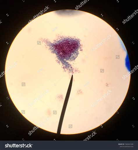 Squamous Cells Reproductive Female Cytology Concept Stock Photo 1583041030 | Shutterstock