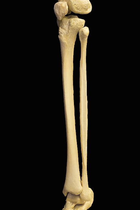 Human Skeleton Showing Lower Leg Bones Greeting Card for Sale by Science Stock Photography
