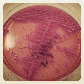 E.coli growing from a urine culture. | Microbiology, Medical laboratory, Lab tech