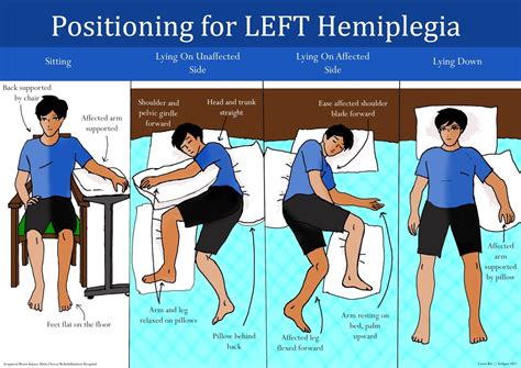 CARING FOR A PERSON LIVING WITH STROKE AT HOME- HOW TO POSITION A STROKE SURVIVOR - Stroke ...