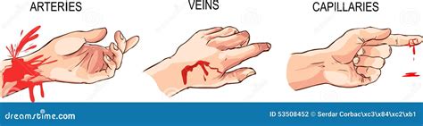 Arterial and Venous Bleeding Stock Vector - Illustration of circulation, professional: 53508452