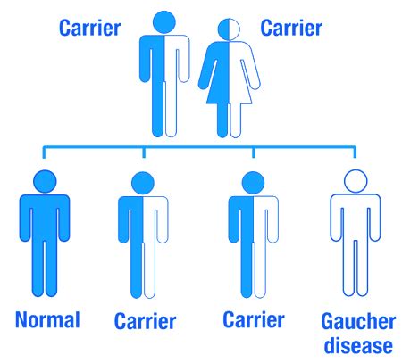 Gaucher Disease-Symptoms, Treatment, Causes, Picture