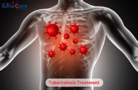 Tuberculosis Treatment - Types, Symptoms, Causes, Treatment Procedure