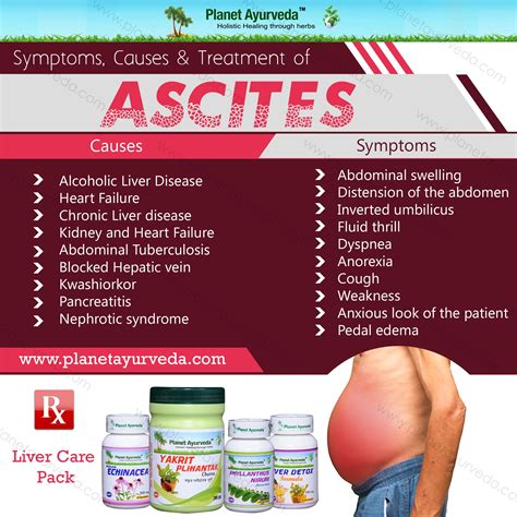 #Ascites is a very nasty condition related to the #gastrointestinal ...