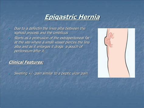 Epigastric Hernia Types