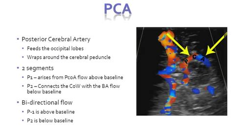 Transcranial Doppler | Ultrasound, Medical ultrasound, Ultrasound school