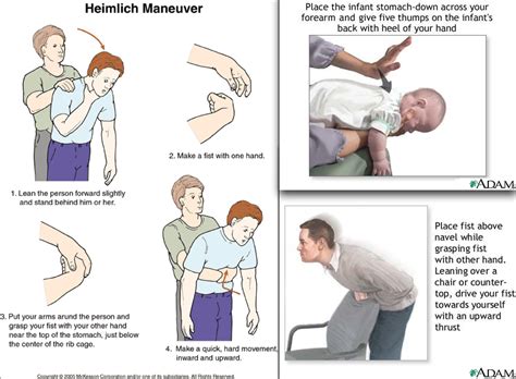 Heimlich Maneuver Chart | Emergency Preparedness | Heimlich maneuver ...