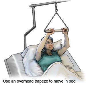 How to Use an Overhead Trapeze - What You Need to Know