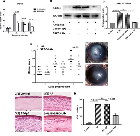 Figure 4 from The Role of SREC-Ⅰ in Innate Immunity to Aspergillus fumigatus Keratitis ...