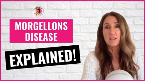 What is Morgellons Disease? (Causes, Symptoms, and Treatment)