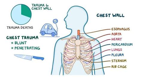 Flail chest symptoms - MEDizzy