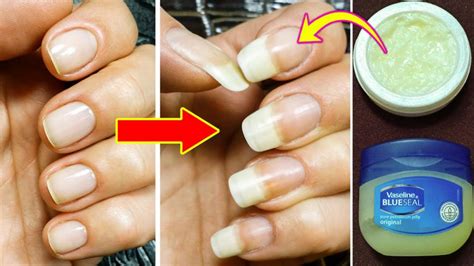 How To Make Your Nails Grow Faster And Stronger, Get Long And Strong Nails In A Week – Man ...