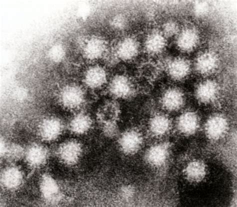 Norovirus | Disease Outbreak Control Division