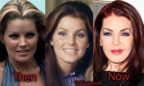 Priscilla Presley Plastic Surgery, Before and After Pictures. #priscillapresley #presley #b ...