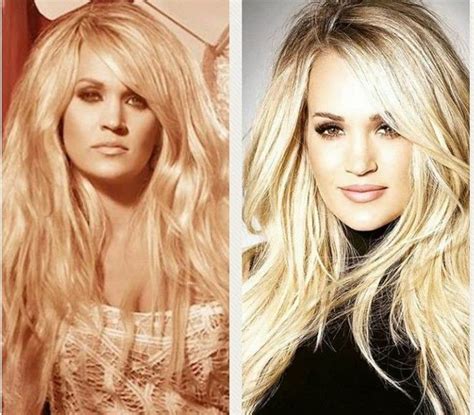 #carrieunderwood before & after her terrible fall! | Carrie underwood ...