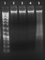 DNA fragmentation assay. Genomic DNA isolated from cells subjected to ...