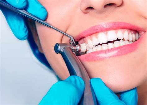 Teeth Cleaning in Sydney | Sydney CBD Dentistry