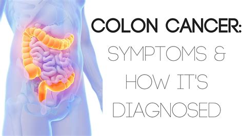 Rectal Cancer Home Remedies: Symptoms Of Colon Cancer