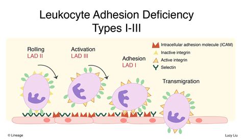 Leukocyte Adhesion Deficiency Type I | 100% Best Guide