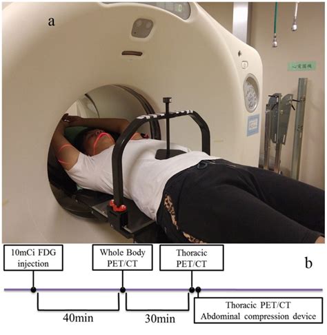 Patient setup with the abdominal compression device (a) located in the... | Download Scientific ...