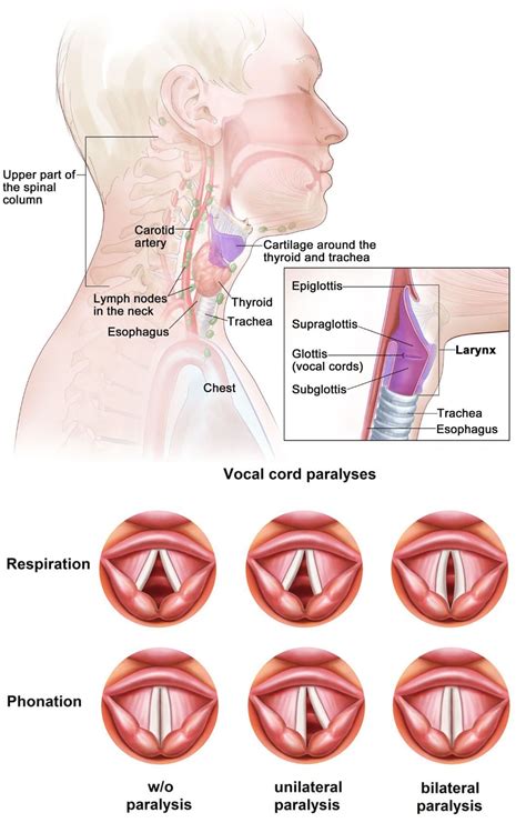 Vocal Cord Injury: EP Chiropractic Scientists