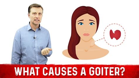 What Causes a Goiter? Causes of Thyroid Enlargement – Dr.Berg - YouTube