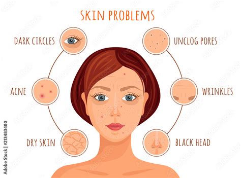 Types of skin problems. Vector illustration. Information banner on the skin care. A woman's face ...