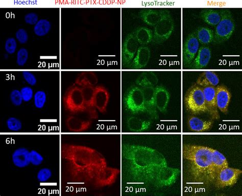 Confocal laser scanning microscopy (CLSM) images of MCF7 cells treated ...