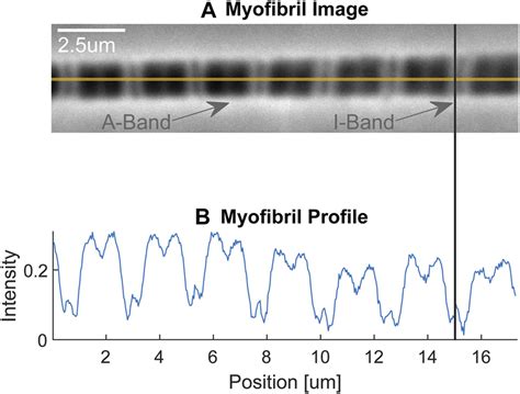 | Schematic illustration of a sarcomere (top) with actin, myosin, and ...