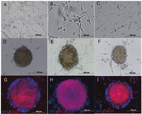 Morphology of GBM cells and GSCs. (A) G1, (B) G2 and (C) G3 GBM cells ...